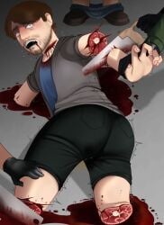 Amputated Arm Rule 34 Image