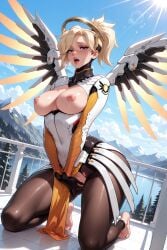 Mercy (Overwatch) Rule 34 Image